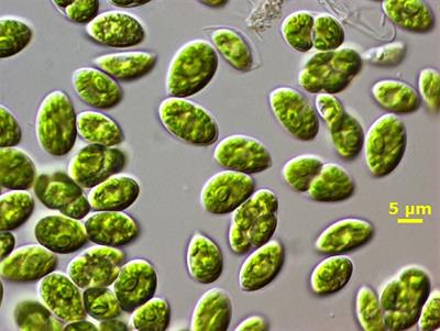 Productivity and nutrient removal by the microalga Chlamydopodium fusiforme grown outdoors in BG-11 and piggery wastewater